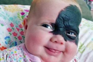 نوزاد عجیب الخلقه