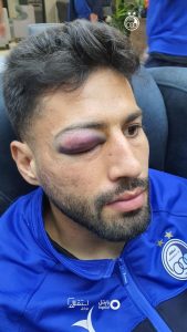 خبر بد برای آبی‌های پایتخت/ مدافع استقلال دربی را از دست می دهد؟