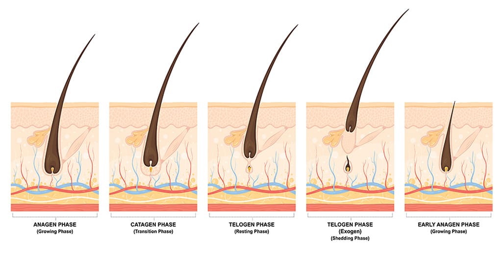 لیزر موهای زائد فول بادی چیست ؟ 2 2 23