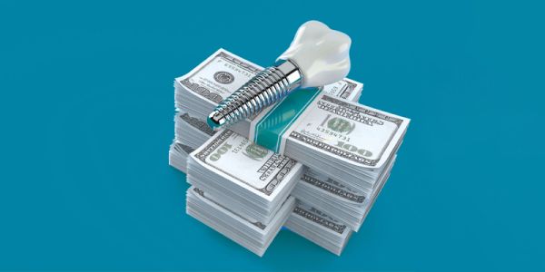 1741735648 935 تحریم‌ها و چالش واردات مواد اولیه ایمپلنت در ایران خبررسان