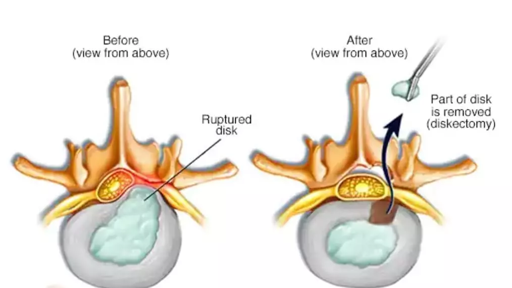 بهترین جراح دیسک کمر در تهران چه ویژگی هایی دارد؟ 2 2 5