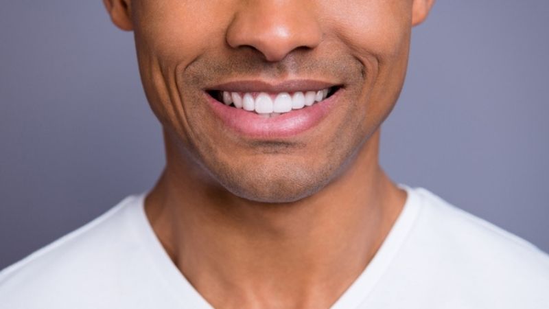 قیمت کامپوزیت دندان در سال 1403 2 2 3