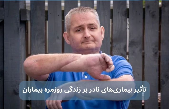 چطور یک بیماری نادر میتواند کیفیت زندگی را سالها تحت تأثیر قرار دهد؟ 2 4 3