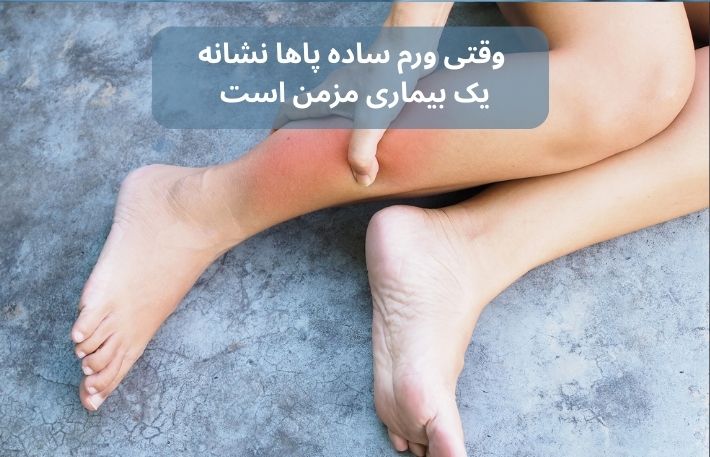 چطور یک بیماری نادر میتواند کیفیت زندگی را سالها تحت تأثیر قرار دهد؟ 3 5 1