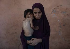 لب های غزه خشک و بی جان است