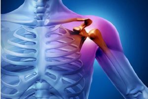 بیماری شانه یخ زده افراد۴۰ سال به بالا را تهدید می‌کند - خبرگزاری مهر | اخبار ایران و جهان