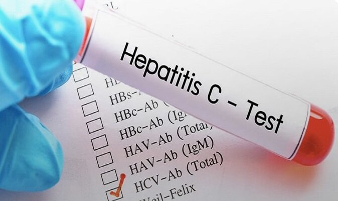 رد ادعای مدیرعامل پرسپولیس؛ هیچ بازیکن هپاتیتی در فوتبال ایران نیست - خبرگزاری مهر | اخبار ایران و جهان