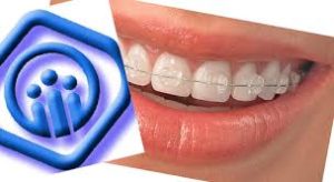 ارتودنسی و بیمه‌ها