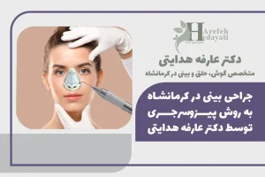 جراحی بینی در کرمانشاه