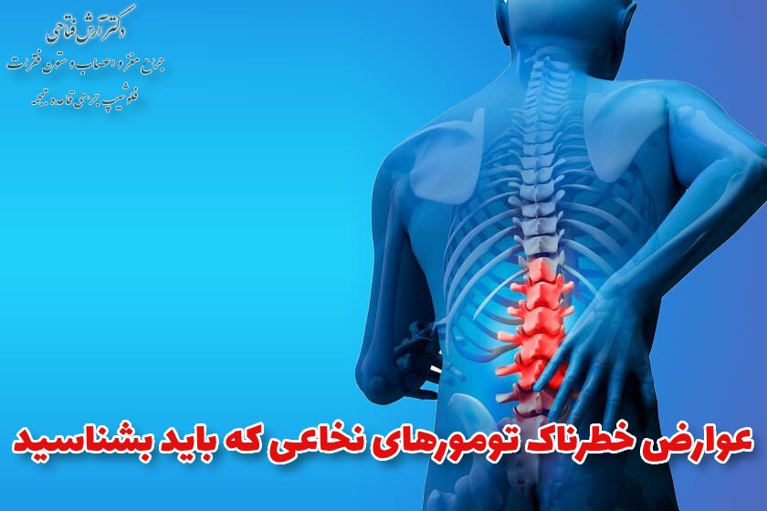 عوارض خطرناک تومورهای نخاعی که باید بشناسید