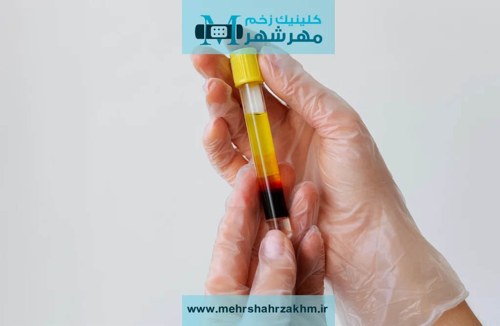 درمان زخم بدون جراحی؛ روش‌های نوینی که کمتر کسی از آن خبر دارد!