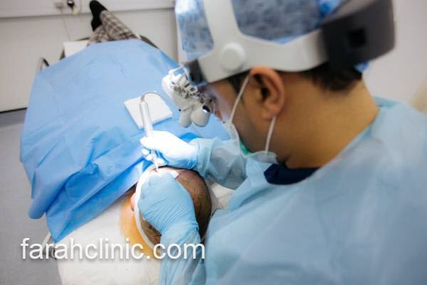 کلینیک کاشت مو در سعادت آباد تهران 2 فرآیند پس از کاشت مو در کلینیک های معتبر | فرح کلینیک