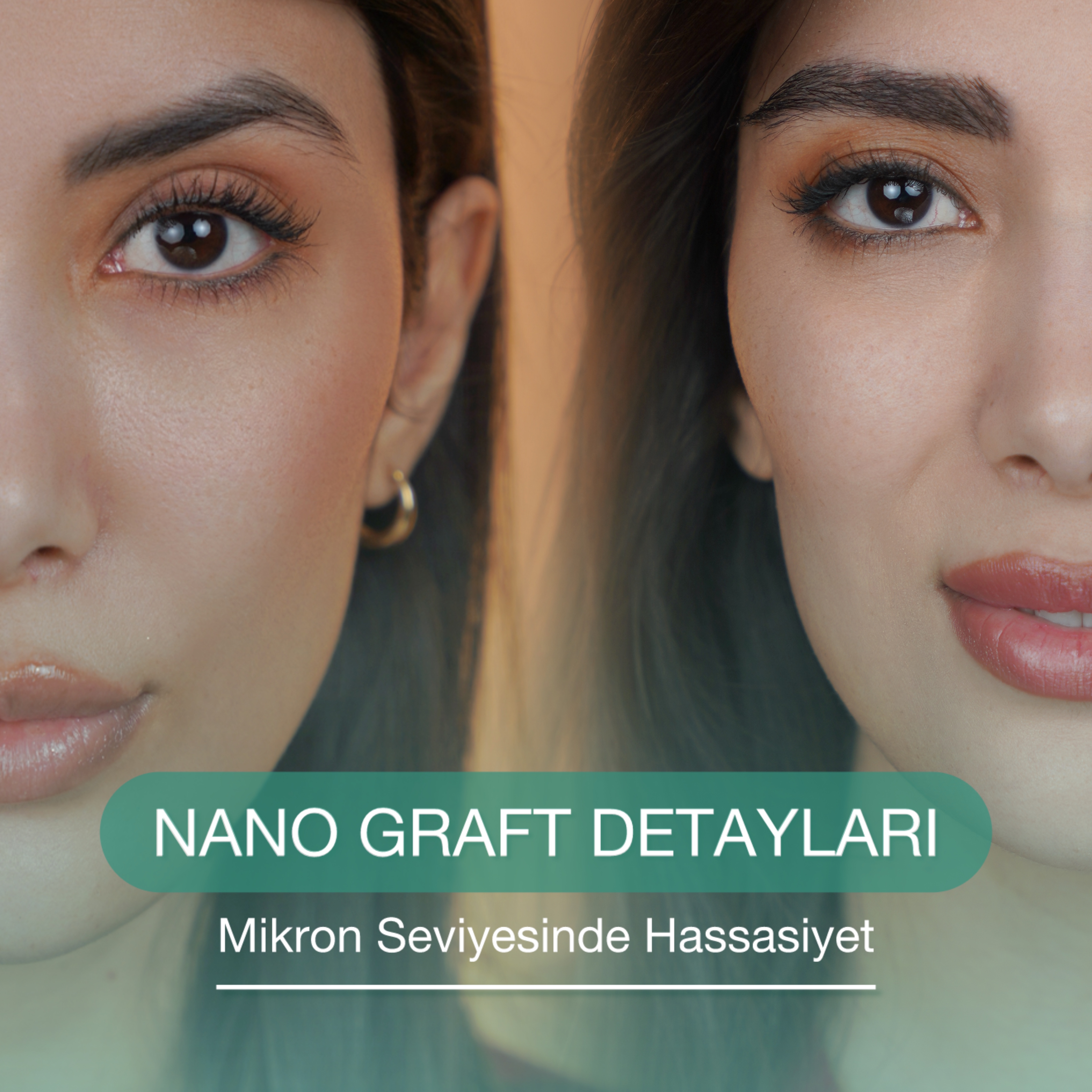 عوارض کاشت ابرو چیست؟ هرآنچه قبل از تصمیم‌گیری باید بدانید